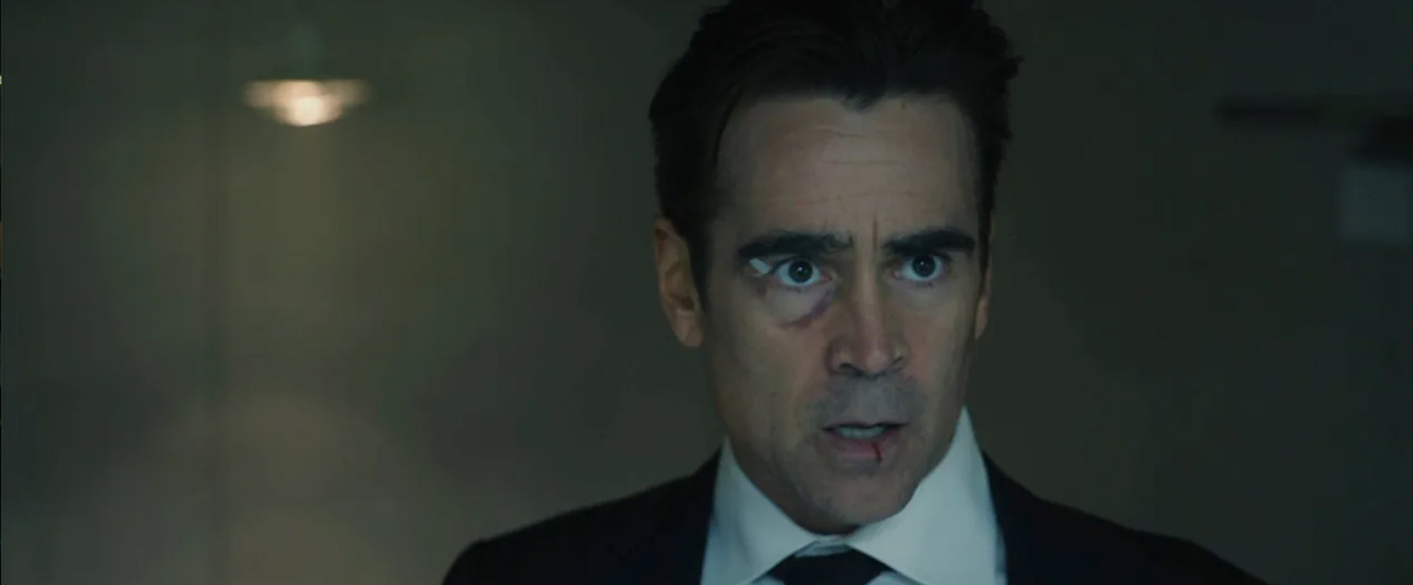 Colin Farrell in a suit with a bandage by his eye and a bloody lip