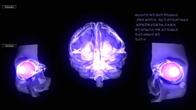 brain and medical graphic with alien text in the top right corner